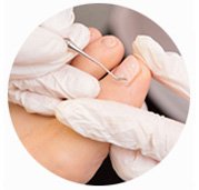 Rekonstrukcja paznokci